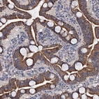 Immunohistochemical staining of human duodenum shows strong cytoplasmic positivity in glandular cells.
