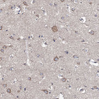 Immunohistochemical staining of human cerebral cortex shows moderate cytoplasmic positivity in neurons.