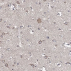 Immunohistochemical staining of human cerebral cortex shows moderate cytoplasmic positivity in neurons.