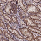Anti-C15orf52 Antibody