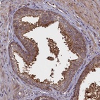 Anti-RBFA Antibody