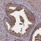 Anti-RBFA Antibody