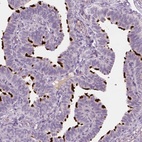 Immunohistochemical staining of human fallopian tube shows high expression.
