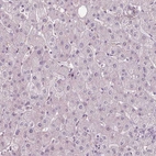 Immunohistochemical staining of human liver shows no positivity in hepatocytes.