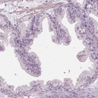 Immunohistochemical staining of human prostate shows low expression as expected.