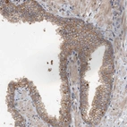Immunohistochemical staining of human prostate shows moderate granular cytoplasmic positivity in glandular cells.