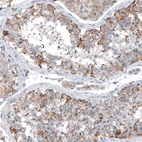 Immunohistochemical staining of human testis shows moderate granular cytoplasmic positivity in cells in seminiferous ducts.