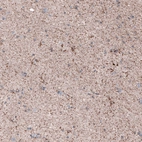 Immunohistochemical staining of human cerebral cortex shows moderate granular cytoplasmic positivity.