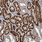 Immunohistochemical staining of human kidney shows strong granular cytoplasmic positivity in cells in tubules.