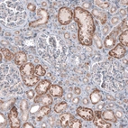 Immunohistochemical staining of human kidney shows moderate granular cytoplasmic positivity in cells in tubules.