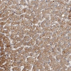 Immunohistochemical staining of human liver shows moderate granular cytoplasmic positivity in hepatocytes.