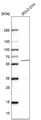 Western blot analysis in human cell line SCLC-21H.