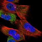 Immunofluorescent staining of human cell line U-251 MG shows positivity in cytoplasm & centrosome.