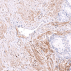 Anti-FERMT2 Antibody