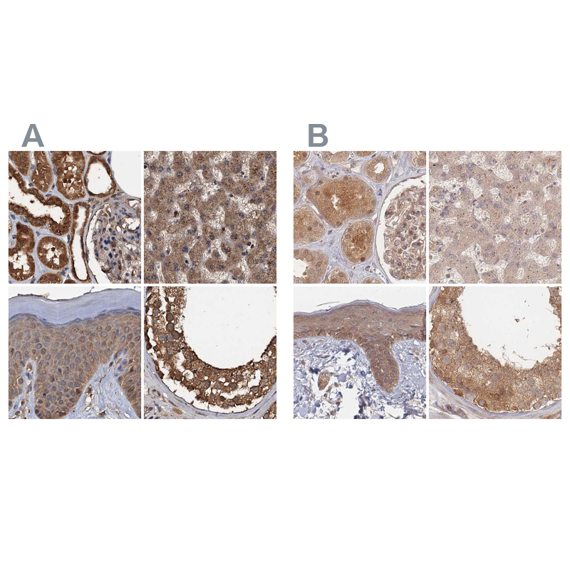 Anti-PSMD9 Antibody