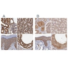 Anti-PSMD9 Antibody