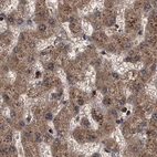 Immunohistochemical staining of human liver using Anti-PSMD9 antibody HPA040512.