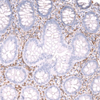 Immunohistochemical staining of human colon shows strong cytoplasmic positivity in lymphoid cells.