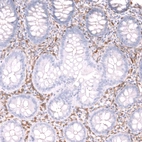 Immunohistochemical staining of human colon shows strong cytoplasmic positivity in lymphoid cells.