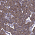 Immunohistochemical staining of human parathyroid gland shows strong cytoplasmic positivity in glandular cells.