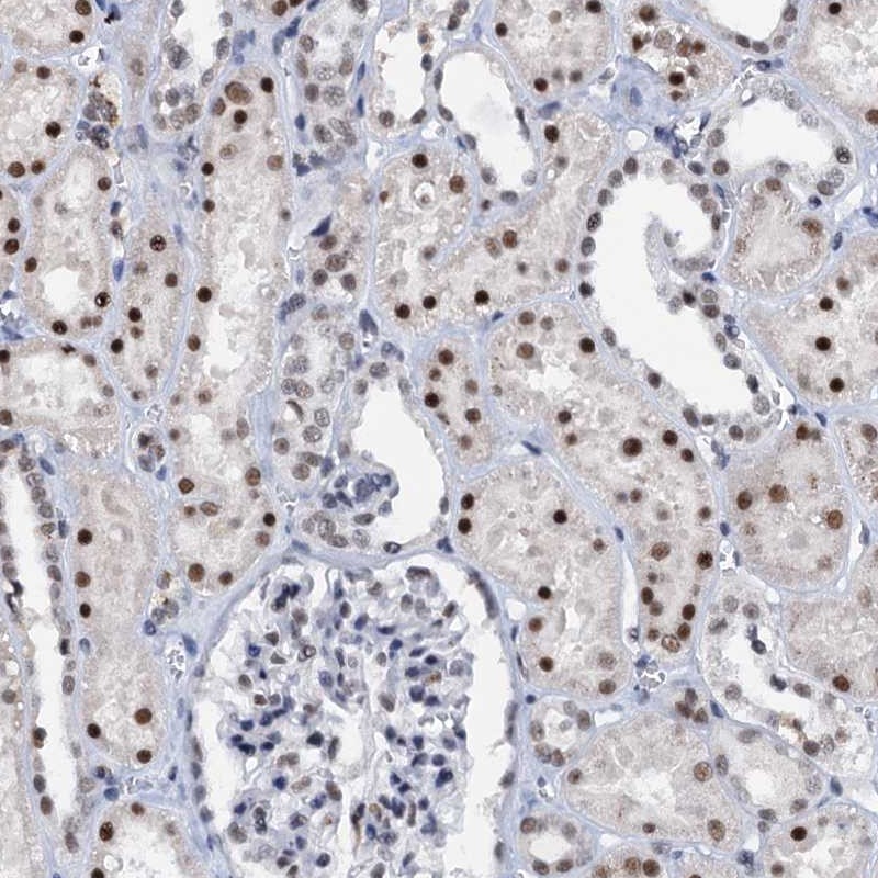 Anti-SNRPD1 Antibody