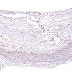 Immunohistochemical staining of human skin shows very weak cytoplasmic positivity in squamous epithelial cells.