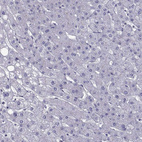 Anti-TMC3 Antibody