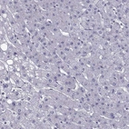 Immunohistochemical staining of human liver shows no positivity in hepatocytes as expected.