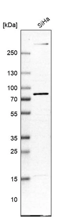 Western blot analysis in human cell line SiHa.