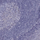 Immunohistochemical staining of human tonsil shows no positivity as expected.