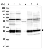 Lane 1: Marker [kDa] 250, 130, 95, 72, 55, 36, 28, 17, 10_br/_Lane 2: Human cell line RT-4_br/_Lane 3: Human cell line U-251MG sp_br/_Lane 4: Human plasma (IgG/HSA depleted)_br/_Lane 5: Human liver tissue_br/_Lane 6: Human tonsil tissue
