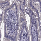 Immunohistochemical staining of human duodenum shows no positivity in glandular cells as expected.
