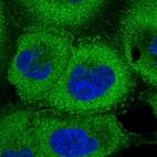 Immunofluorescent staining of human cell line A-431 shows localization to plasma membrane & cytosol.