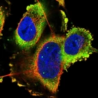 Immunofluorescent staining of human cell line U-251 MG shows localization to cytosol.