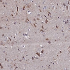 Immunohistochemical staining of human Cerebral cortex shows strong membranous and cytoplasmic positivity in neuronal cells.