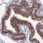 Immunohistochemical staining of human Fallopian tube shows strong membranous and cytoplasmic positivity in glandular cells.