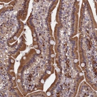 Immunohistochemical staining of human Duodenum shows moderate cytoplasmic positivity in glandular cells.