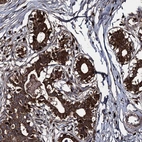 Immunohistochemical staining of human breast shows strong cytoplasmic positivity in glandular cells.