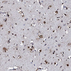 Immunohistochemical staining of human cerebral cortex shows strong cytoplasmic positivity in glial cells.