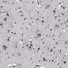 Immunohistochemical staining of human cerebral cortex shows strong cytoplasmic positivity in glial cells.