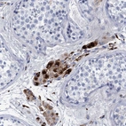 Immunohistochemical staining of human testis shows strong cytoplasmic positivity in Leydig cells.