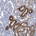 Immunohistochemical staining of human kidney shows strong cytoplasmic positivity in cells in tubules.