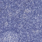 Immunohistochemical staining of human tonsil shows no positivity in non-germinal center cells as expected.