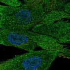 Immunofluorescent staining of human cell line ASC TERT1 shows localization to plasma membrane.