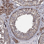Anti-NRIP3 Antibody