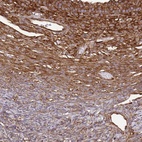 Anti-EEF2 Antibody