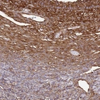 Anti-EEF2 Antibody