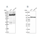 Western blot analysis using Anti-EEF2 antibody HPA040534 (A) shows similar pattern to independent antibody HPA057351 (B).
