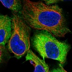 Immunofluorescent staining of human cell line HEK 293 shows localization to plasma membrane, cytosol & aggresome.