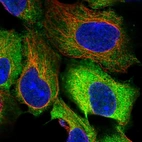 Immunofluorescent staining of human cell line HEK 293 shows localization to plasma membrane, cytosol & aggresome.